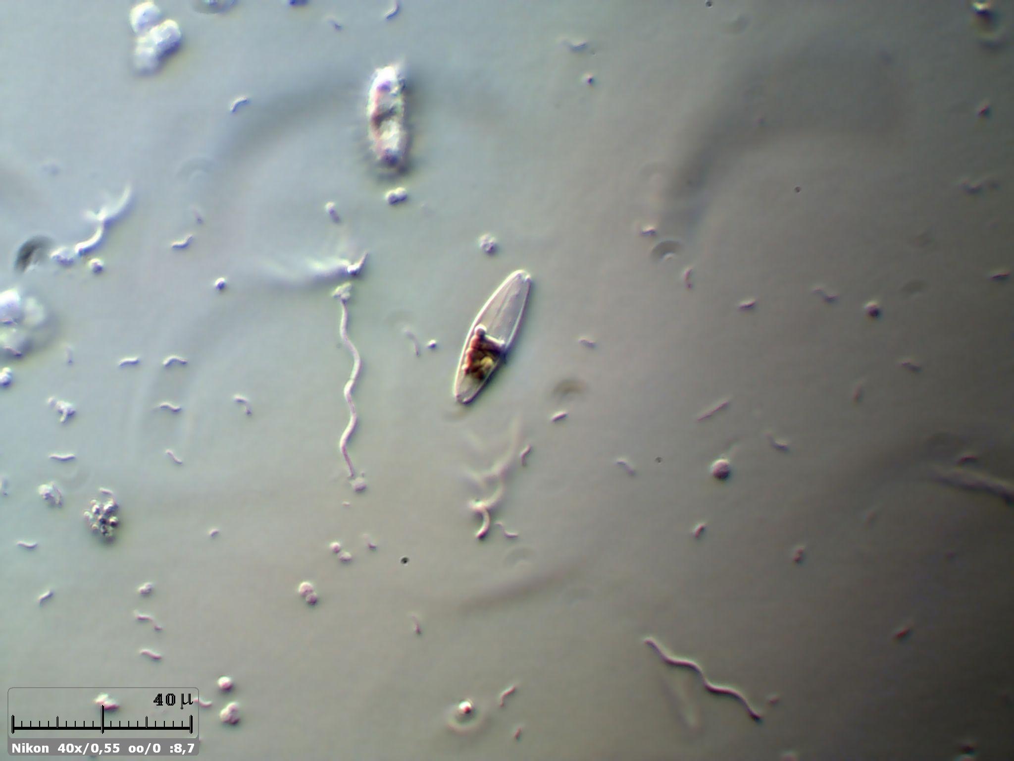 Non sempre i batteri sono i pi� piccoli